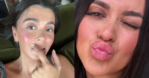 Admitting Her ‘Puffy Face and Mustache’ Came from Fillers, Love Island Star Decides to Wipe Them Out Completely