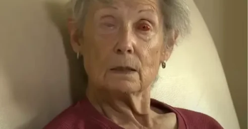 Una mujer ciega ahora puede ver a través de su diente gracias a una extraña cirugía