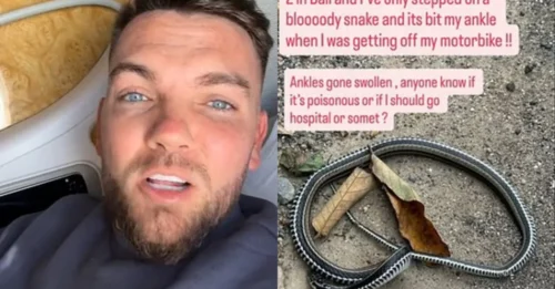 Bitten Upon Arrival: 'Love Island' Star Sam Gowland in Fight for His Life After Venomous Snake Bite in Bali Just Hours After Landing