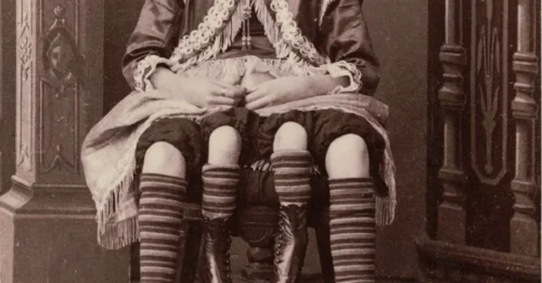 Mujer nacida con cuatro patas tiene siete hijos tras acto degradante de 'espectáculo de fenómenos'