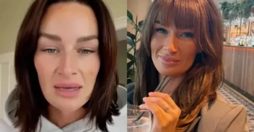 On-Air 'Beauty' Pressure: MAFS UK Bride Cornered and FORCED to Confess EVERY Procedure Under Public Scrutiny!