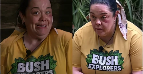 ‘What’s happened to Lisa’s eye…?’ I’m A Celebrity’s Lisa Riley sparks concern among viewers as fans spot a surprising change in her appearance — with worried campmates and audiences questioning whether she’s been bitten in the jungle…